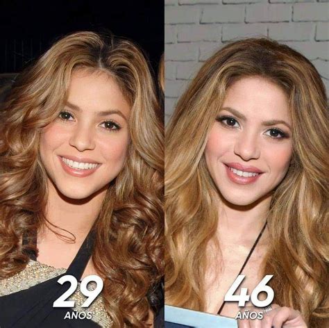 did shakira get plastic surgery|shakira facelift.